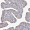 Zinc Finger CCCH-Type Containing 6 antibody, NBP1-81909, Novus Biologicals, Immunocytochemistry image 