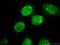 KI-67 antibody, 27309-1-AP, Proteintech Group, Immunofluorescence image 