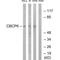 ATP/GTP Binding Protein Like 4 antibody, A14810, Boster Biological Technology, Western Blot image 