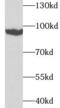 Transglutaminase 1 antibody, FNab08649, FineTest, Western Blot image 