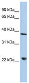 DEAD-Box Helicase 25 antibody, TA341586, Origene, Western Blot image 