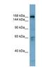 Dedicator of cytokinesis protein 2 antibody, NBP1-58870, Novus Biologicals, Western Blot image 