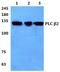 Phospholipase C Beta 2 antibody, PA5-75551, Invitrogen Antibodies, Western Blot image 