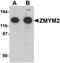 Zinc Finger MYM-Type Containing 2 antibody, orb95587, Biorbyt, Western Blot image 