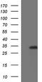 TGFB Induced Factor Homeobox 2 antibody, TA590467, Origene, Western Blot image 