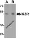 Tachykinin Receptor 3 antibody, 4255, ProSci Inc, Western Blot image 