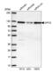 Kinesin Family Member C3 antibody, NBP1-86021, Novus Biologicals, Western Blot image 