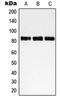 Non-SMC Condensin I Complex Subunit H antibody, LS-C353346, Lifespan Biosciences, Western Blot image 