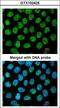 Tumor Protein P63 antibody, LS-C185484, Lifespan Biosciences, Immunocytochemistry image 