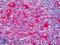 Pleckstrin antibody, LS-B4393, Lifespan Biosciences, Immunohistochemistry frozen image 
