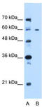 Centrosomal Protein 55 antibody, TA339345, Origene, Western Blot image 