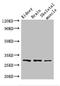 Phospholipase D6 antibody, LS-C679055, Lifespan Biosciences, Western Blot image 