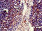 Melanotransferrin antibody, A62954-100, Epigentek, Immunohistochemistry paraffin image 
