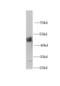 4-Hydroxyphenylpyruvate Dioxygenase antibody, FNab03993, FineTest, Western Blot image 
