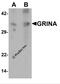 Glutamate Ionotropic Receptor NMDA Type Subunit Associated Protein 1 antibody, 7147, ProSci, Western Blot image 