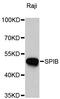 Spi-B Transcription Factor antibody, STJ29587, St John