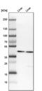 4-Hydroxyphenylpyruvate Dioxygenase antibody, PA5-58343, Invitrogen Antibodies, Western Blot image 