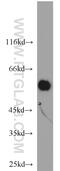 1-Aminocyclopropane-1-Carboxylate Synthase Homolog (Inactive) antibody, 11491-1-AP, Proteintech Group, Western Blot image 