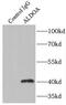 Aldolase, Fructose-Bisphosphate A antibody, FNab00301, FineTest, Immunoprecipitation image 
