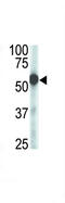 Zinc Metallopeptidase STE24 antibody, 61-385, ProSci, Western Blot image 