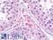Prickle Planar Cell Polarity Protein 2 antibody, LS-B9642, Lifespan Biosciences, Immunohistochemistry paraffin image 