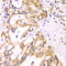 Acyl-CoA Dehydrogenase Short Chain antibody, LS-C331159, Lifespan Biosciences, Immunohistochemistry frozen image 