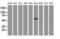 Glucosylceramidase Beta 3 (Gene/Pseudogene) antibody, NBP2-00521, Novus Biologicals, Western Blot image 