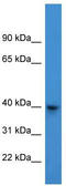 Actin Related Protein T3 antibody, TA342881, Origene, Western Blot image 