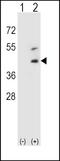 Decorin antibody, PA5-13538, Invitrogen Antibodies, Western Blot image 
