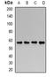 Galactosamine (N-Acetyl)-6-Sulfatase antibody, orb340920, Biorbyt, Western Blot image 