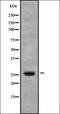 Putative protein TIGA1 antibody, orb338589, Biorbyt, Western Blot image 