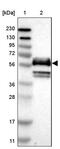 Prolylcarboxypeptidase antibody, PA5-53543, Invitrogen Antibodies, Western Blot image 