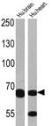 ADAM Metallopeptidase With Thrombospondin Type 1 Motif 5 antibody, PA1-1742, Invitrogen Antibodies, Western Blot image 