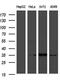 Phospholipid Scramblase 2 antibody, M12303, Boster Biological Technology, Western Blot image 