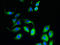 Fetal And Adult Testis Expressed 1 antibody, orb35308, Biorbyt, Immunocytochemistry image 