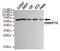 Switching B Cell Complex Subunit SWAP70 antibody, STJ99160, St John