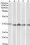 Apoptosis Inducing Factor Mitochondria Associated 1 antibody, TA348927, Origene, Western Blot image 