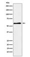 P21 (RAC1) Activated Kinase 3 antibody, M03124, Boster Biological Technology, Western Blot image 