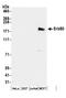 Receptor tyrosine-protein kinase erbB-3 antibody, A304-370A, Bethyl Labs, Western Blot image 