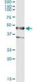 Septin 1 antibody, H00001731-M03, Novus Biologicals, Immunoprecipitation image 