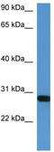 Homeobox protein Hox-B1 antibody, TA329256, Origene, Western Blot image 