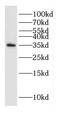 Deleted in azoospermia-like antibody, FNab02252, FineTest, Western Blot image 