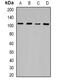 Lysine Demethylase 7A antibody, abx142063, Abbexa, Western Blot image 