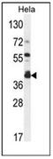 Delta 4-Desaturase, Sphingolipid 2 antibody, AP51233PU-N, Origene, Western Blot image 