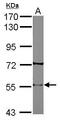 Nicotinic Acetylcholine Receptor beta antibody, PA5-29792, Invitrogen Antibodies, Western Blot image 