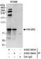 Phosphoinositide-3-Kinase Regulatory Subunit 2 antibody, A302-594A, Bethyl Labs, Immunoprecipitation image 