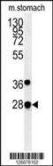 Prolylendopeptidase-like antibody, 61-977, ProSci, Western Blot image 