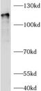Arf-GAP with GTPase, ANK repeat and PH domain-containing protein 2 antibody, FNab00205, FineTest, Western Blot image 