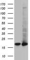 Ubiquitin Conjugating Enzyme E2 D4 (Putative) antibody, TA810786S, Origene, Western Blot image 