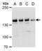PHD Finger Protein 2 antibody, GTX129028, GeneTex, Western Blot image 